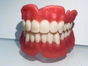 DLP 3D Printed Custom Full-mouth Resin Dentures