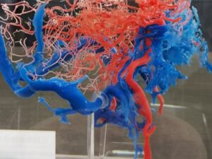 PolyJet 3D Printed Scaled-up Fullcolor Capillary Vessel