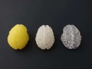 3D Printed Brain Models with SLA Clear Resin, PolyJet Rubber and DLP Silicone