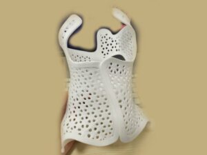 MJF 3D Printed White Nylon Back Brace for Scoliosis Patients