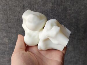 SLA 3D Printed Resin Bone Models as Medical Teaching Aids