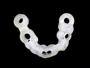 SLA 3D Printed Teeth Implant Guide with Formlabs Durable Resin