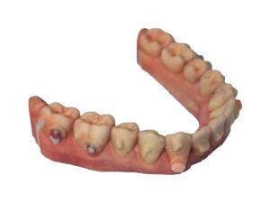 PolyJet 3D Printed Full-color Resin Dental Arches Model