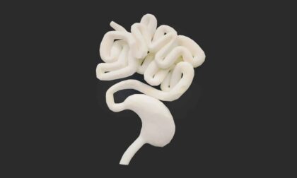 SLA 3D Printed Gastrointestinal Tract Anatomical Model