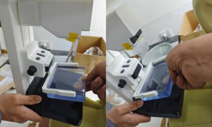SLA 3D Printed Scaled Mammography Device Prototype