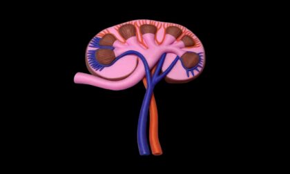 Mimaki 3D Printed Full-color Kidney Anatomy Model